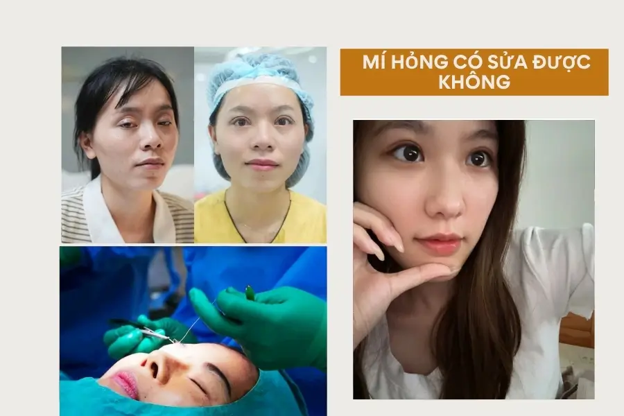 Mí hỏng, lỗi có khắc phục được không