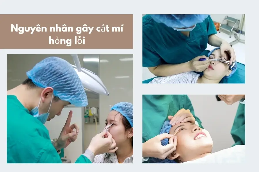 Nguyên nhân gây tác hại của cắt mí mắt