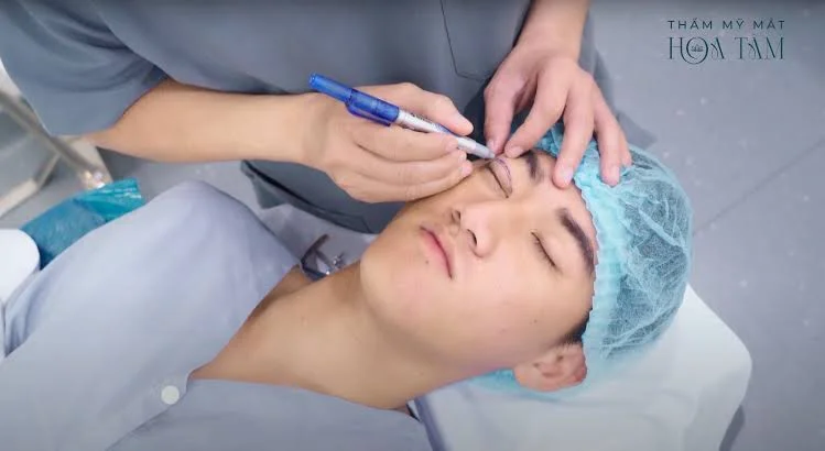 Thẩm Mỹ Mắt Hoa Tâm – Đơn vị chuyên sâu về thẩm mỹ mắt