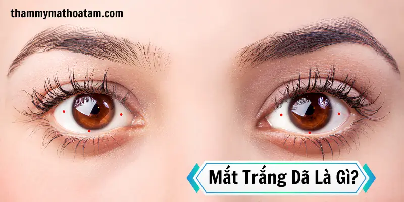 Đặc điểm đôi mắt trắng dã Đặc điểm đôi mắt trắng dã