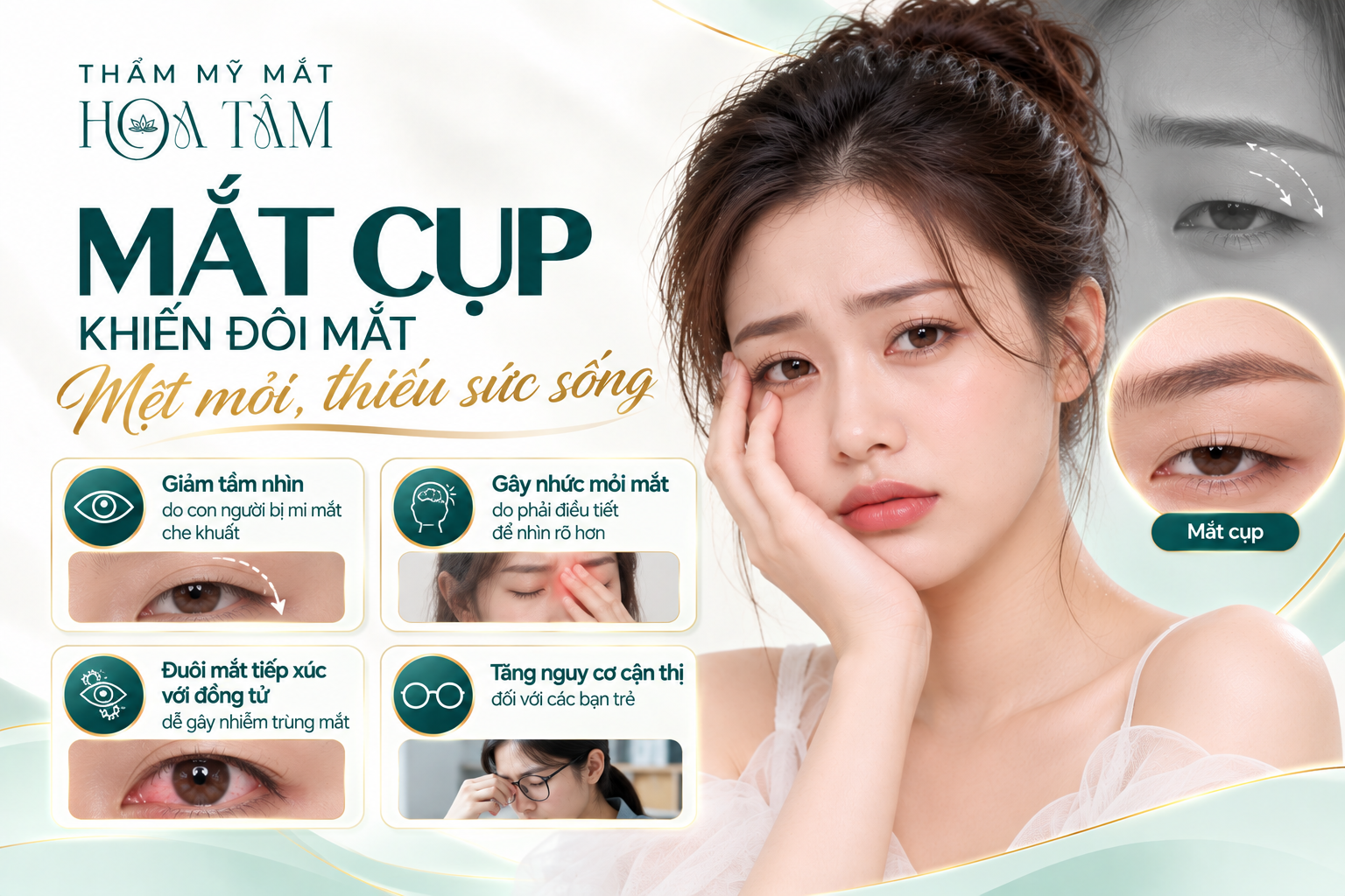 Mắt cụp khiến đôi mắt mệt mỏi, thiếu sức sống Mắt cụp khiến đôi mắt mệt mỏi, thiếu sức sống