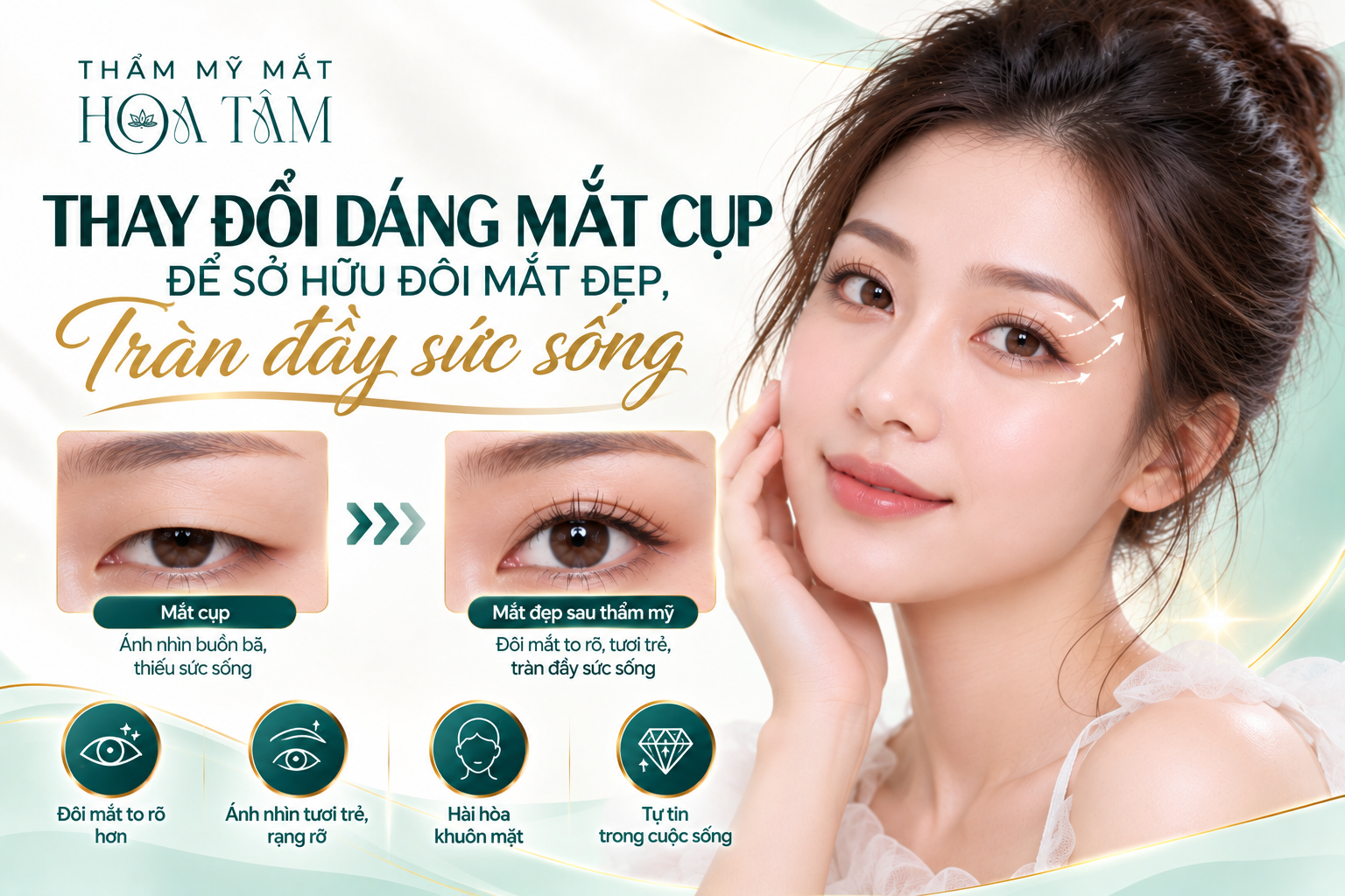Thay đổi dáng mắt cụp để sở hữu đôi mắt đẹp, tràn đầy sức sống. Thay đổi dáng mắt cụp để sở hữu đôi mắt đẹp, tràn đầy sức sống.